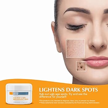 Age Spot Remover Cream, Fade Cream for Dark Spots on Face, Hand and Neck, with Kojic Acid, Alpha Arbutin and Mulberry, 2oz - Baker's Best