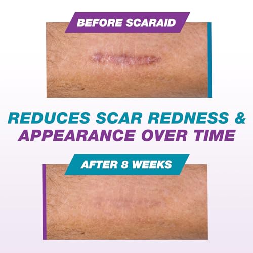 Silicone Scar Gel Stick for Scars After Surgery, C Section & Keloid Treatment – Silicone Scar Gel for Surgical Scars, Deep Scar Removal, Scar Aid & Scar Cream for Old and New Scars – 4.25g