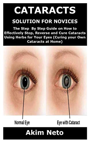 CATARACTS SOLUTION FOR NOVICES: The Step By Step Guide on How to Effectively Stop, Reverse and Cure Cataracts Using Herbs for Your Eyes (Curing your Own Cataracts at Home)