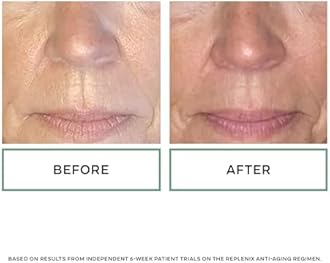 Replenix Age Restore Nighttime Therapy Face Cream, Anti-Aging Medical-Grade Facial Moisturizer for Mature & Dry Skin