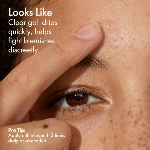 Origins Super Spot Treatment for Acne | Treats & Prevents Acne Blemishes | With Salicylic Acid, 0.3 Fl Oz - Image 6