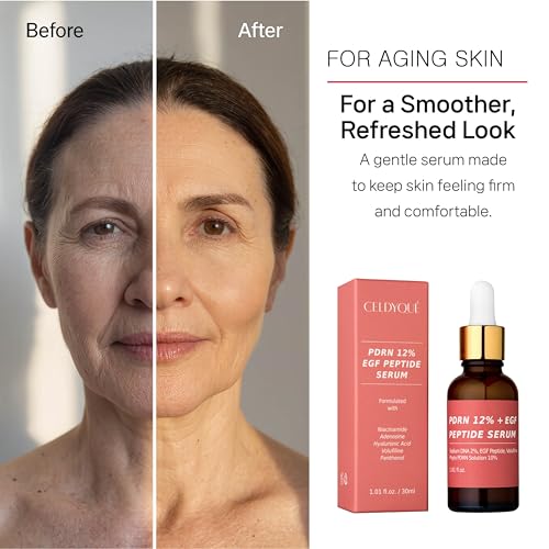 Image of Salmon DNA PDRN 120,000 ppm EGF Peptide Microneedling Serum w /Volufiline, Phyto PDRN 12%, Growth Factor - Anti-Aging Face Serum with Niacinamide, Hyaluronic Acid 1 Fl Oz Korean Skincare