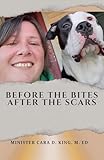 BEFORE THE BITES, AFTER THE SCARS: A Story of Survival, Sobriety, and Spiritual Awakening (English Edition)