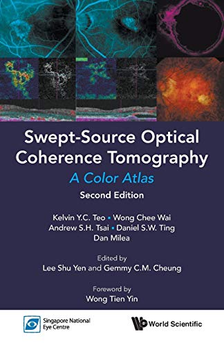 Swept-Source OCT: A Color Atlas (Second Edition)