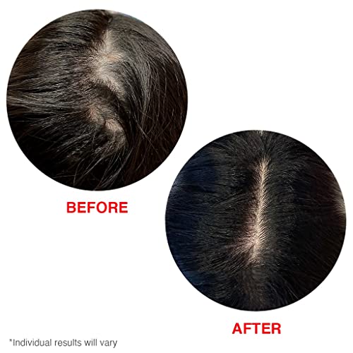 Hairtamin Scalp Serum Natural Hair Growth Thickening Treatment | Visibly Increases Thicker Looking Hair And Promotes Scalp Health | Nourishes & Hydrates Dry, Itchy Scalp #TOP5