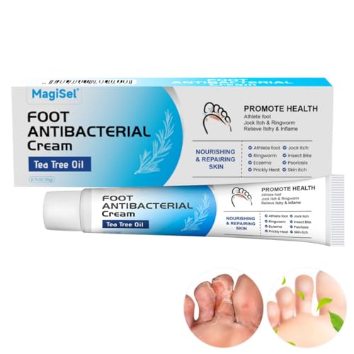 Gel para hongos en los pies, crema contra la picazón, hongos en los pies, crema de olores...