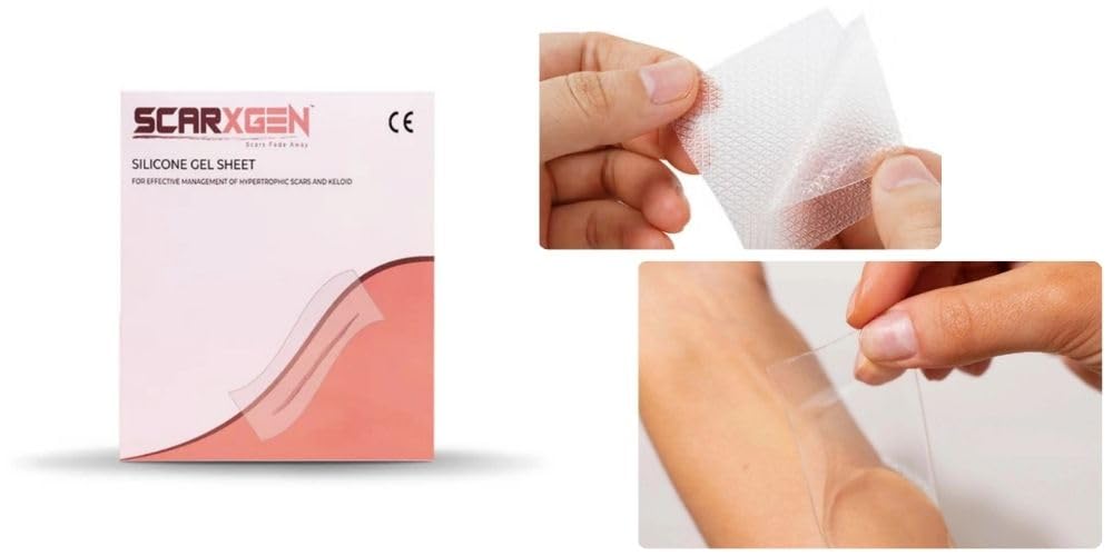 Scarxgen Silicone Gel Sheet for Scar Treatment – 6cm x 15cm | Reusable, Medical Grade | Reduces Keloid, Surgical, Burn & Surgery Scar | Hypoallergenic & Flexible (Box of 1 Unit)