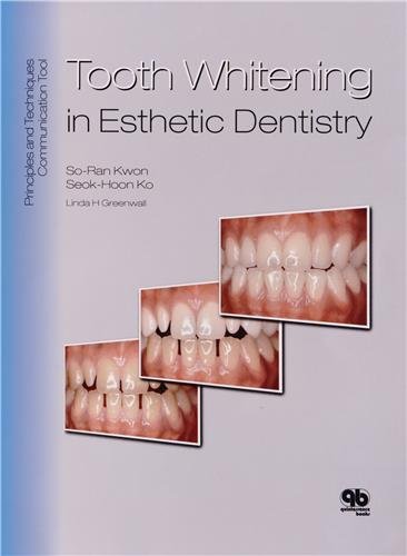 Buy Tooth Whitening in Esthetic Dentistry: Principles and Techniques — BookShops.in