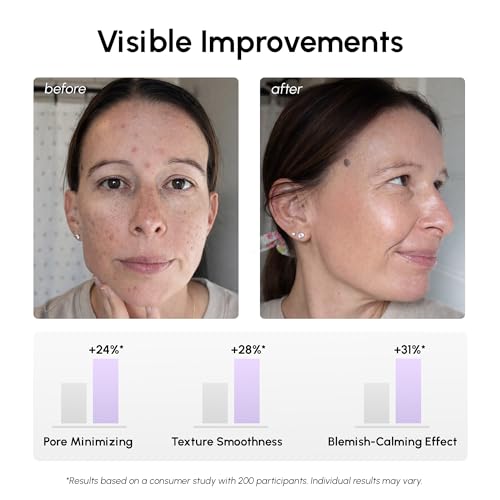 Image of MAREE Niacinamide Toner Pads for Face - Exfoliating Pads with 12% Niacinamide, Salicylic Acid, Hyaluronic Acid & Tea Tree - Zero Pore, Uneven Skin Tone, Acne Clearing Facial Pads - Glow Up Device