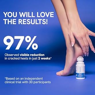 Be Bodywise 20% Urea Foot Cream Roll On 50ml | For Dry & Cracked Heels | With 2% Lactic Acid, Olive Oil & Vitamin E | Helps Repair and Moisturise Cracked Heels