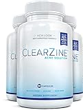 ClearZine Acne Solution - Best Natural Acne Pills for Rapid Acne Treatment and Radiant Skin | Reduce Skin Redness and Breakouts for Clear Skin with Pantothenic Acid and Zinc, 90 Capsules (3 Bottles)