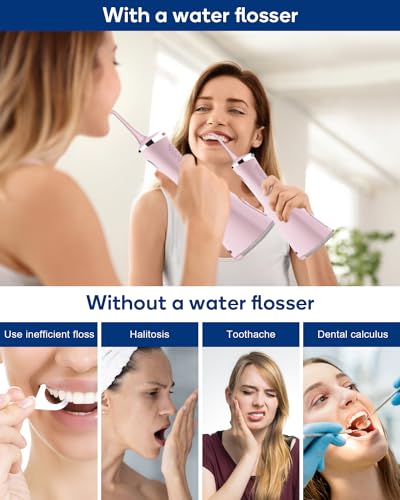 MySmile Wasser Zahnseide für Zähne Kabellose Munddusche 5 Reinigungsmodi 8 Austauschbare Jet Tips IPX 7 Wasserdicht USB Wiederaufladbare Wasser Dental Picks für Zahnreinigung mit PU Beutel Rosa – Bild 6