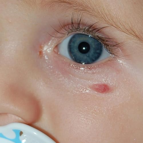 &ldquo;The EYES Have it: The Overlap of Kids' Skin & Eye Conditions&rdquo; (Don&rsquo;t Be Rash: The Pediatric Dermatology Podcast: Y2025, Episode 8 )