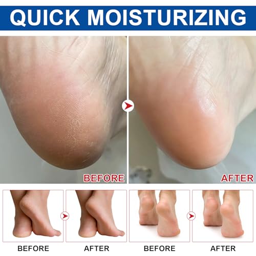 Fußcreme mit 60% Urea für Sehr Trockene, raue und Rissige Haut, Urea Creme 60 prozent für Ellenbogen, Knie, Füßen & Händen, Fußpflege Fusscreme, 2PCS