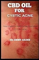 CBD OIL FOR CYSTIC ACNE: Your Complete guide to the Treatment of Cystic Acne B08DC84FNH Book Cover