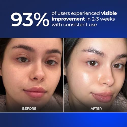 Image of Aqueria Brightening Multi Active French Serum for Glowing Skin | 3% Niacinamide, 2% Alpha Arbutin | Fades Dark Spots, Targets Pigmentation & Dryness | Reduces Dullness to Make Skin More Even-Toned | Daily Use Serum | For All Skin Types | Infused with French Waters & French Actives | Dermatologist Tested | Lightweight, Non-Comedogenic | 15ml