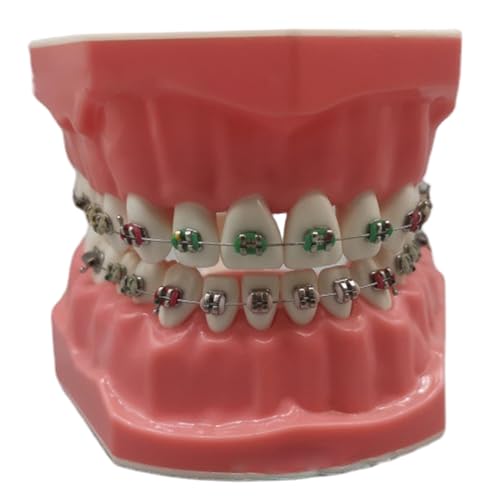 Modelo de dentadura tipodonto interactivo con brackets y alambres metálicos para niños y adultos