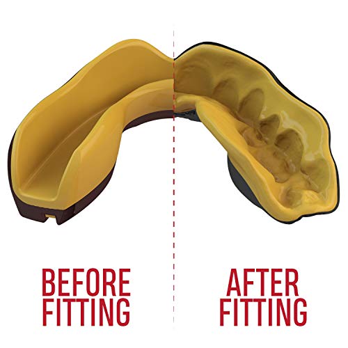 Safejawz Mouthguard Slim Fit, Adults And Junior Mouth Guard With Case For Boxing, Basketball, Lacrosse, Football, Mma, Martial Arts, Hockey And All Contact Sports (Adults 12+ Years, Gold) #TOP2