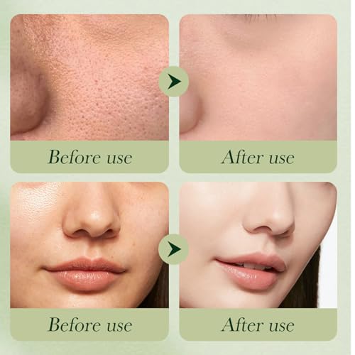 Avocado-Skin-Care-Hydration-Gifts-6-In-1-Travel-Essentials-Skincare-Set-for-Women-CleanserTonerEye-CreamWrinkle-ScrumFace-LotionHydrate-CreamVegan-Anti-Aging-Free-Facial-kit