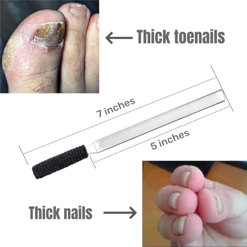 IDOU Zehennagelfeilen für dicke Nägel, Edelstahl, 4 Seiten, 17,8 cm Länge, Nagelfeilen für Männer, Senioren und Hunde