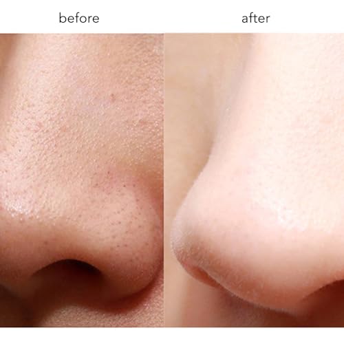 Cremas Y Tratamientos, Video On Demand Imagen adicional