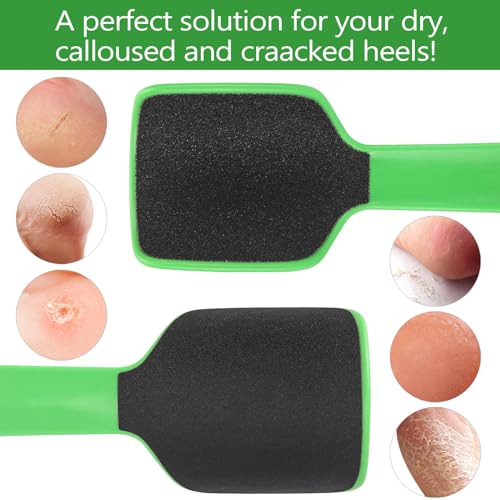 Btyms 202308311 2 Pcs Curved Foot File Callus Remover thumb #4