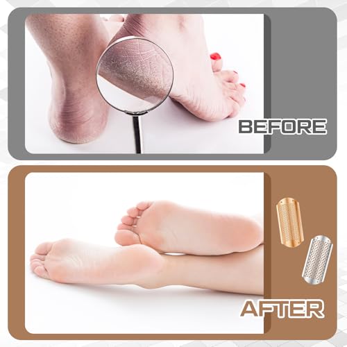 Image of Moxweyeni 8 Pack Rose Gold,Silver Foot File Callus Remover Replacement Blades Metal Pedicure Rasp Hard Skin Remove Scrubber Stainless Steel 2 Designs Big /fine Hole for Detachable Foot Grater