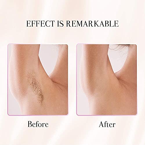 Epilator For Women Epilator For Women Facial Hair Removal Epilator Hair Removal For Women Facial Hair Removal For Women Leg Arm Bikini Armpit Smooth Glide Epilator For Women Facial Hair #TOP1
