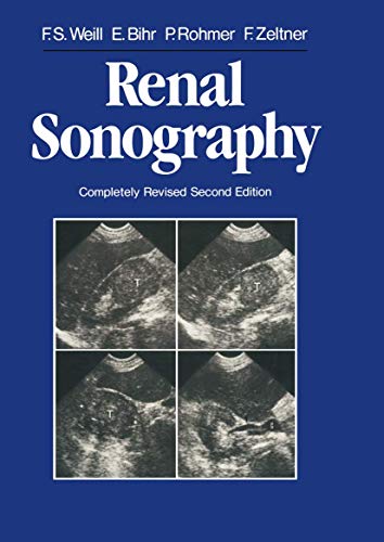 Renal Sonography view 2