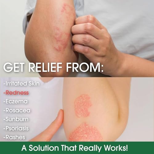 Green Leaf Naturals - Manuka Honey Face Cream - 4oz -Aloe Vera - Jojoba Oil Infused - Body Cream - Gluten Free Moisturizer for Kids & Adults - Nourishing Skin Care