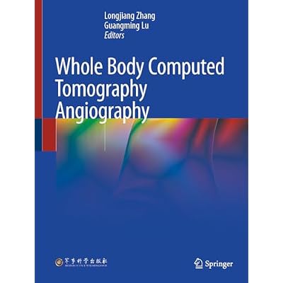 Whole Body Computed Tomography Angiography