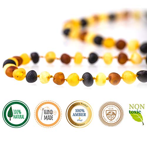 Seven Whales Natural Baltic Amber Adult 20 Inch Necklace – Raw Mix Baroque