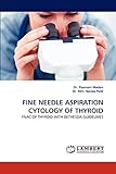 FINE NEEDLE ASPIRATION CYTOLOGY OF THYROID: FNAC OF THYROID WITH BETHESDA GUIDELINES