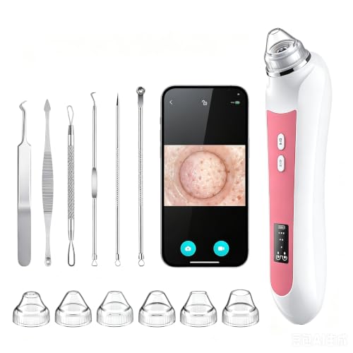 Image of HD Camera USB Blackhead Remover Vacuum, 3 Modes 6 Suction Heads | 1080P lens & 8 LED fill lights, 20x skin magnification, photo & video capture, long-lasting battery, full accessory kit
