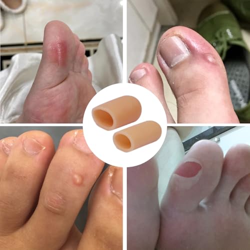 Image of Silicone Big Toe Protectors, Toe Caps Covers Sheeves to Provide Relief from Missing Calluses or Ingrown Toenails, Corns, Blisters, Hammer Toes (Small)