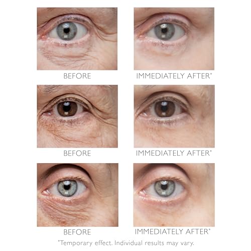 Peter Thomas Roth Instant FIRMx Eye Temporary Eye Tightener 15ml – Quick-Fix Gel to Firm, Tighten & Smooth Crow’s Feet, Fine Lines, Puffiness & Wrinkles for Youthful, Radiant Look - Image 3