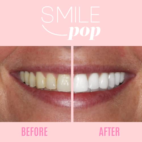 Smile Pop Teeth Whitening Pen For Sensitive Teeth Contains 18% Carbamide Peroxide Whitening Gel, Easy To Use, Effective, Painless, Non-Sensitive, Vegan, Gluten Free, Non-Toxic, Sugar Free And Non-Gmo #TOP2