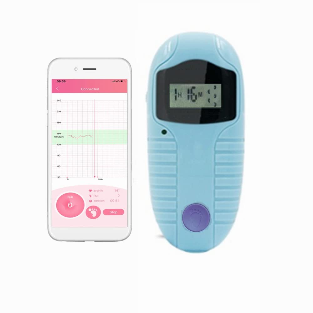Baby Belly Kick Prenatal Heart Rate Monitor for Pregnancy, Listen Track and Share Your Baby's Heartr