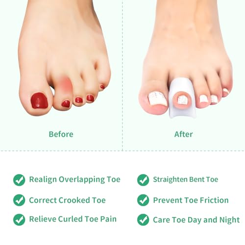 Image of Niupiour Gel Hammer Toe Correctors - Bunion Corrector for Women and Men, 6 Pack of Silicone Toe Separators /Straighteners for Bent Toe, Toe Spacers for Correct Claw Toe, Curled Toe, Crooked Toe
