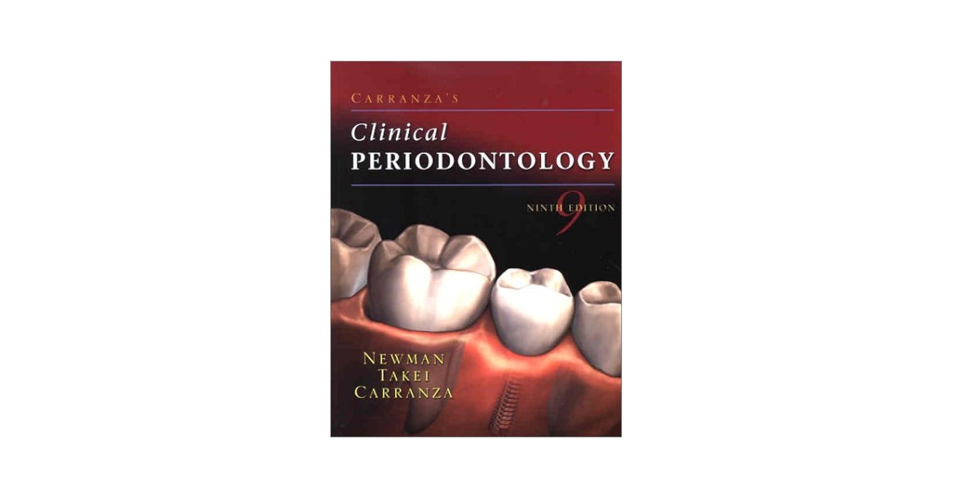 Carranza's Clinical Periodontology: 9780721683317: Medicine