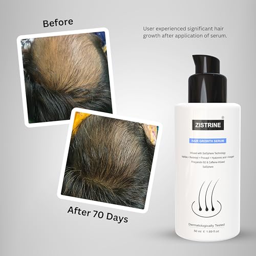 Image of Hair Growth Serum Salsphere Technology - 3% Redensyl, 3% Procapil, 3% Salsphere NHGP, 4% Anagain, 1% Hairiline - Significant Reduce Hair Fall & Stimulate Hair Growth | 50ml
