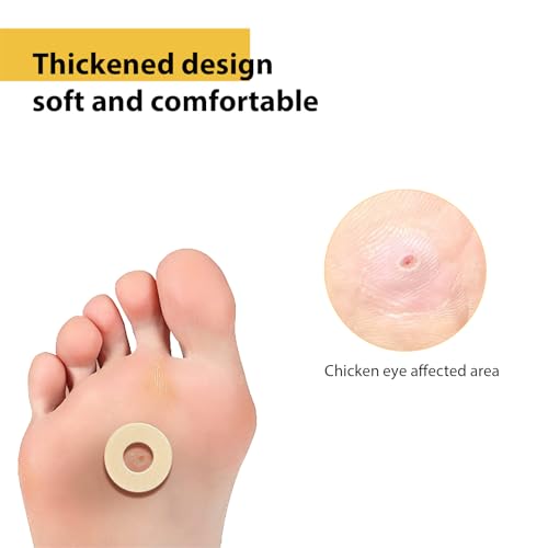 Image of 75 PCS Small Corn Cushion Pads for Feet, Toe Cushions for Corns