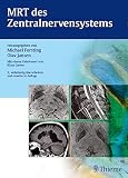 MRT des Zentralnervensystems