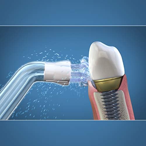Waterpik Końcówka do Irygatora Plaque Seeker, Wymienna Końcówka do Czyszczenia Implantów, Koron, Mostków, Działa z Modelami WP-450 i WP-100, 2 Sztuki (PS-100E)
