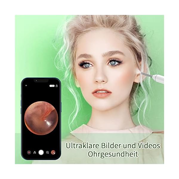 Ohrenschmalz Entferner Otoskop, VITCOCO Wifi Ohrenreiniger Kamera, 1920P Ultradünne HD Drahtlos wasserdicht Ohrenspiegel… – Bild 4