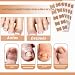 Imagen de Juego de 50 parches de corrección de uñas encarnadas con 50 tiras de alisado de uñas de los pies sin dolor y elevador de uñas