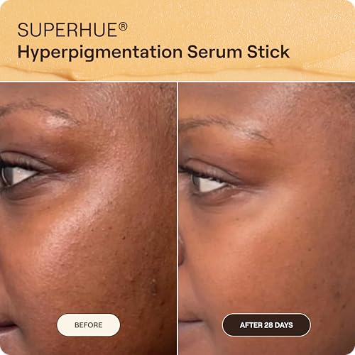 Image of Live Tinted Superhue Hyperpigmentation Serum Stick for Dark Spots, 0.35oz