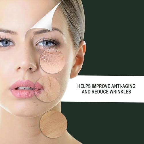 Image of Geek Lab Professional Gold Plated 192 Needles Titanium Alloy Derma Roller, Gold, 1mm for Acne Skin & Hair Loss By Stimulating Natural Healing Responses.