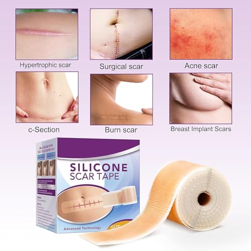 Silicone Scar Tape Roll, 1.6” x 60” Medical Tape for Wound Care Bandages Scars Strips for Surgical Scars Keloid, C-Section, Burns, Injuries Acne, Stretch Marks Removal Sheet Tapes (1.6” x 60”)