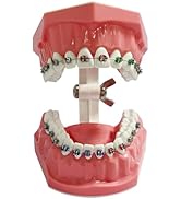 Orthodontic Dental Model with Brackets for Educational Demonstration - Silicone Teeth Typodont wi...